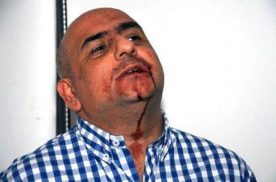 De Narv�ez, denunciado por pegarle a un periodista en La Plata