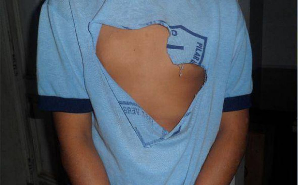 Otra vez las patotas: golpearon salvajemente a un chico 