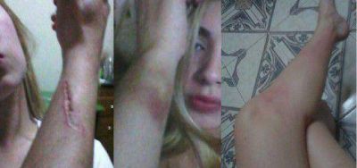 #NiUnaMenos: modelo posade�a denunci� en Facebook a su ex novio por golpes y amenazas de muerte