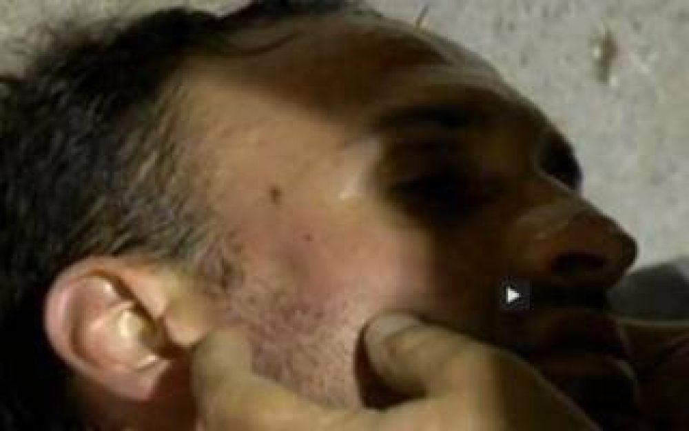 F�tbol: Jugador de Merlo con hundimiento de un p�mulo por un codazo