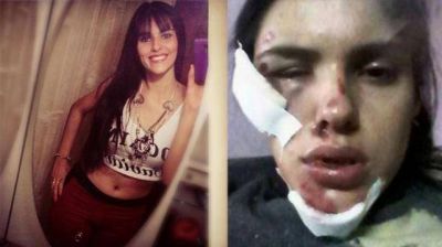 La empujaron para robarle la moto y qued� desfigurada