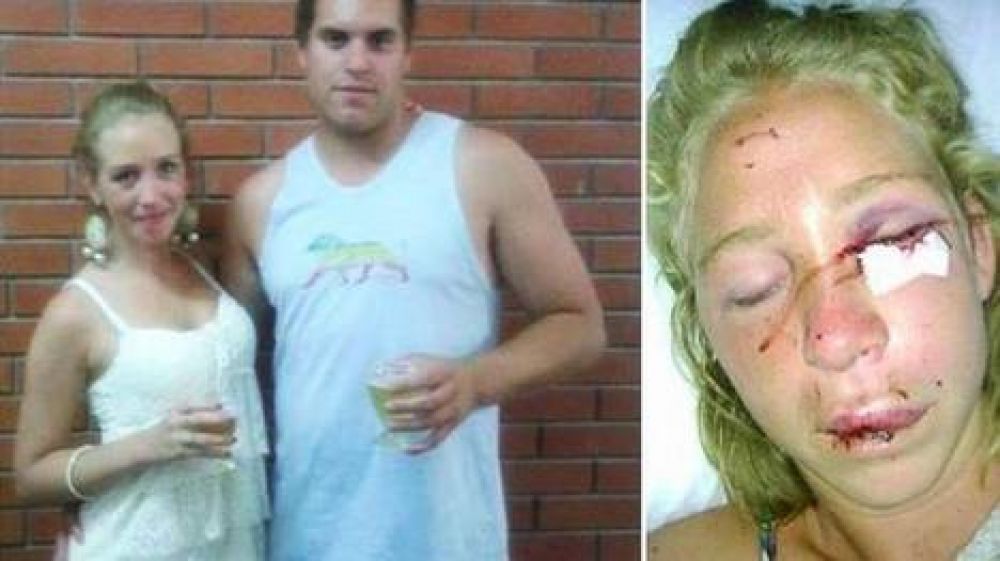 Acuchillaron en la c�rcel al hombre detenido tras desfigurar a su novia en un boliche