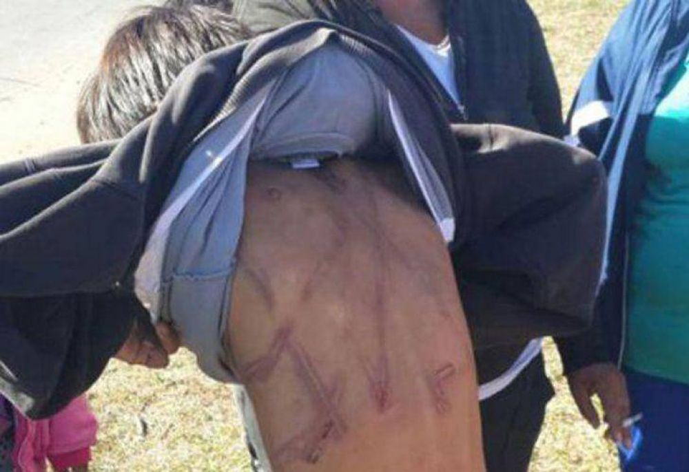 Azot� a sus hijos con un cable por haber perdido la tarjeta para cobrar un plan social