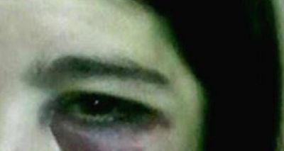 Golpe� a su exmujer en la v�a p�blica cuando fue a buscar sus hijos tras festejar el D�a del Padre