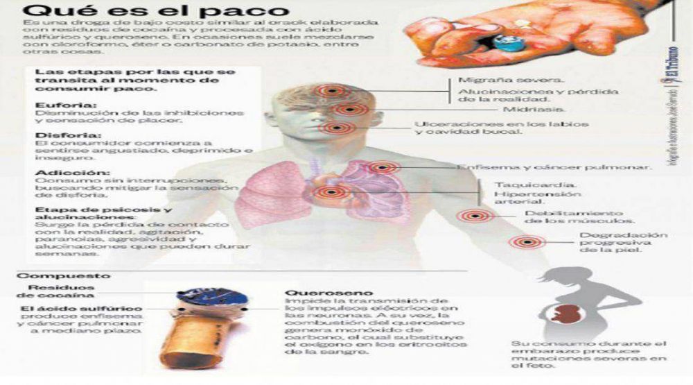 El 40% de las adictas atendidas en el Materno estaba embarazad	a