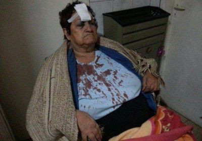 Tres delincuentes agredieron brutalmente a dos jubiladas y les desvalijaron la casa