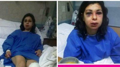 Una mujer vivi� una odisea tras ser brutalmente golpeada por su ex pareja