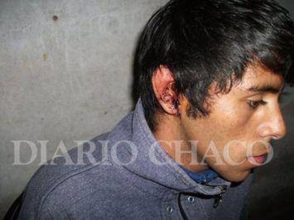 Nos encontramos ante un caso de salvajismo policial�, dijo el abogado que representa al joven golpeado por efectivos de Quitilipi