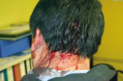 Salvaje agresi�n a un trabajador petrolero