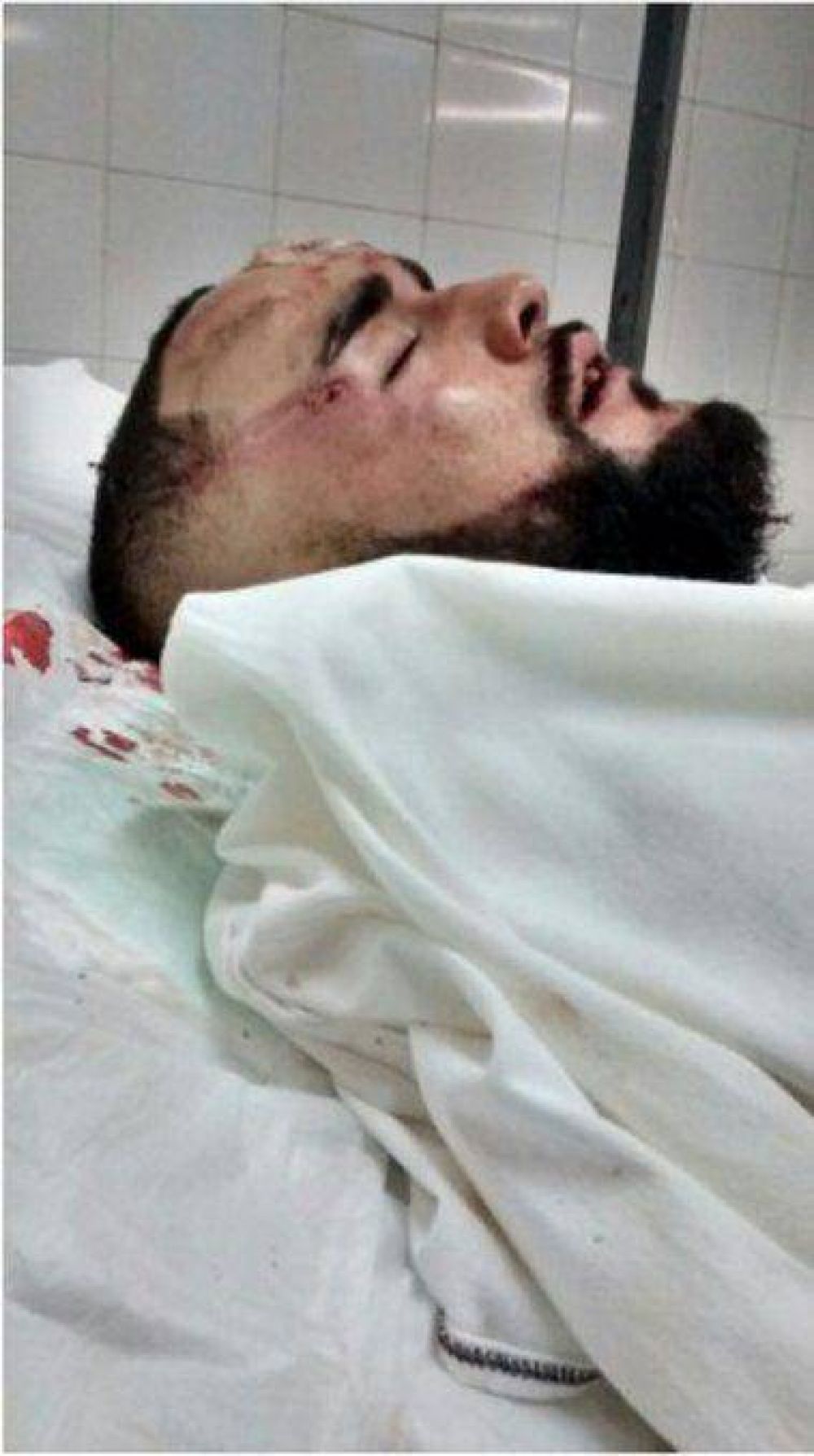 Un joven fue brutalmente golpeado por patovicas en un boliche de Provincia