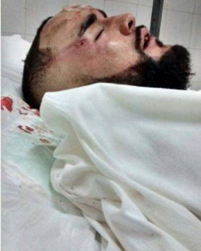 Un joven fue brutalmente golpeado por patovicas en un boliche de Provincia