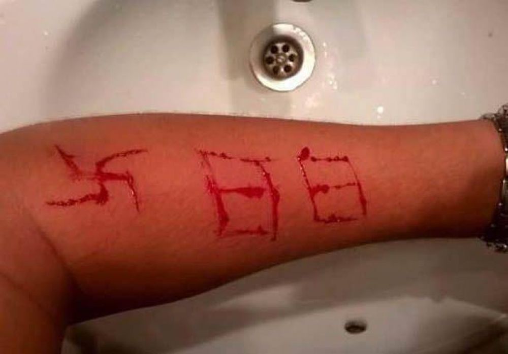Pandilla neonazi ataca a un adolescente español, y dibuja una esvástica en su brazo