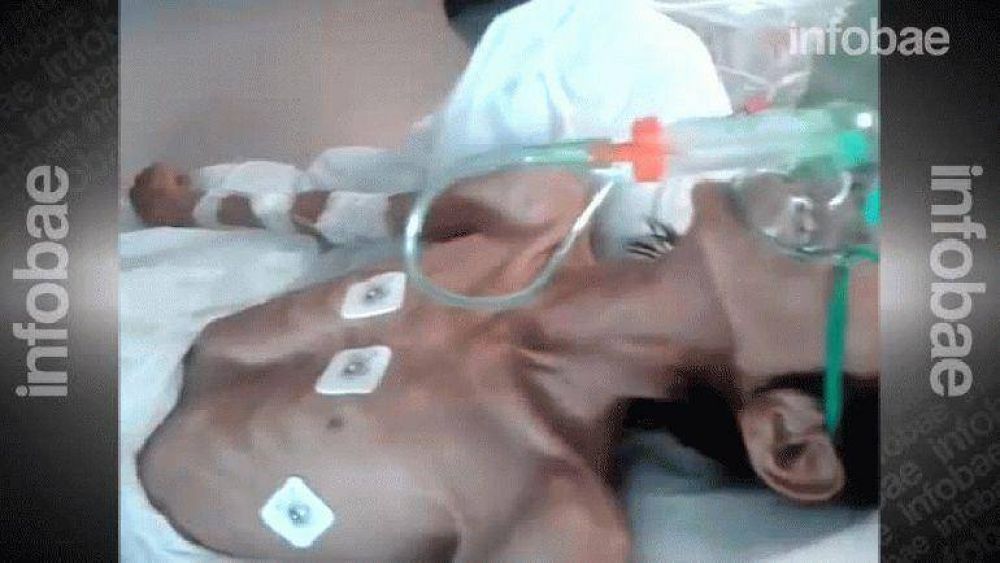 Otra vez Chaco: muri� de desnutrici�n un adolescente Qom que pesaba 9 kilos