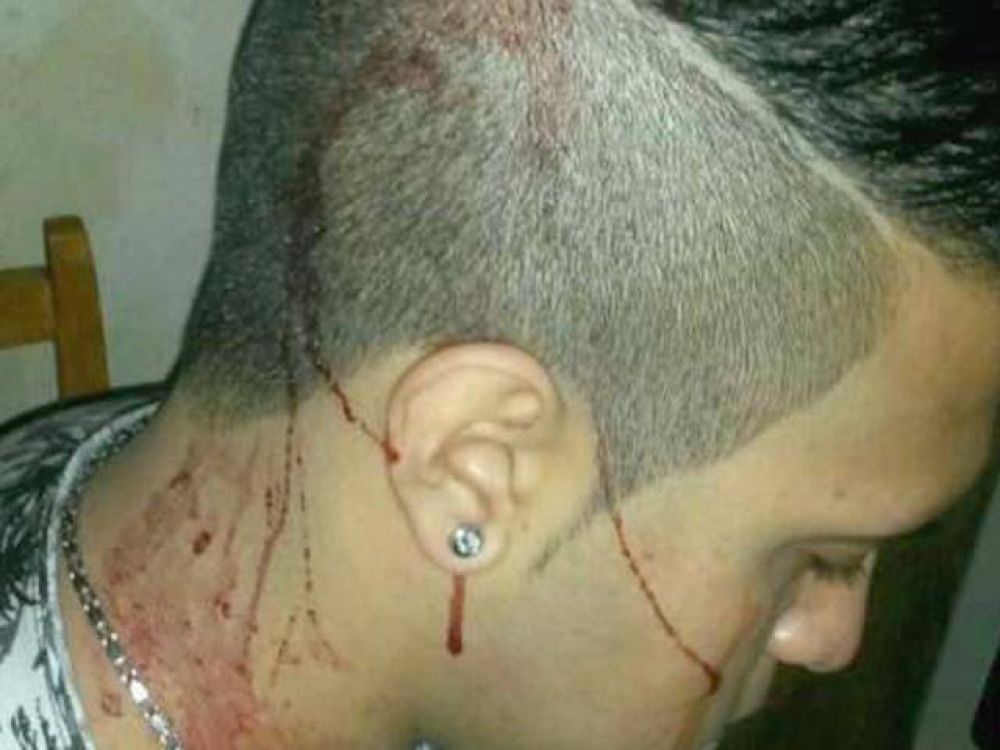 Golpearon brutalmente a un joven para robarle el auto