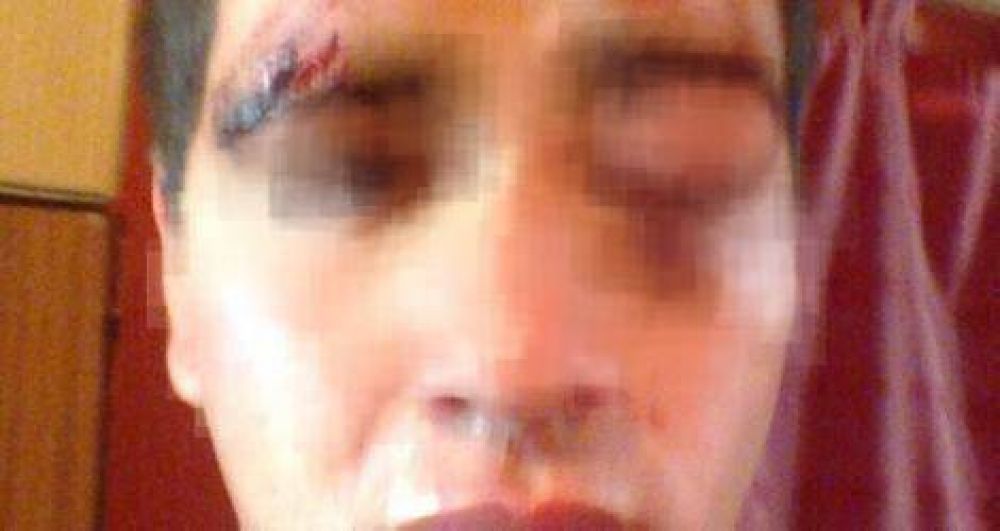 R�o Tala: Denuncian que un joven fue brutalmente golpeado durante un cumplea�os