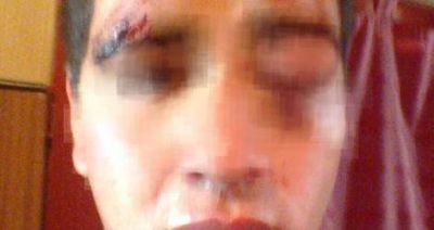 R�o Tala: Denuncian que un joven fue brutalmente golpeado durante un cumplea�os