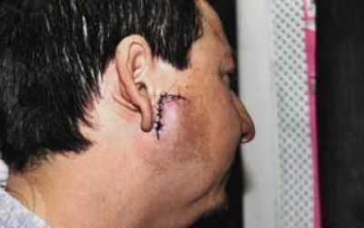 Tres Arroyos: Le gritaron groser�as a una mujer y terminaron en el hospital
