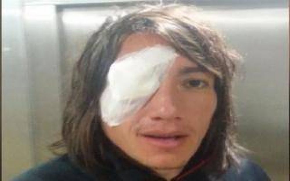 Primer incidente tras el retorno de los hinchas visitantes: Le pegaron un piedrazo a Lug�ercio