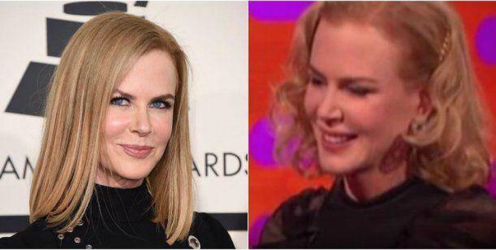 �Qu� le pas�? La nueva cara de Nicole Kidman, sin movimiento