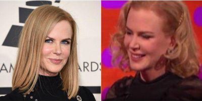 �Qu� le pas�? La nueva cara de Nicole Kidman, sin movimiento