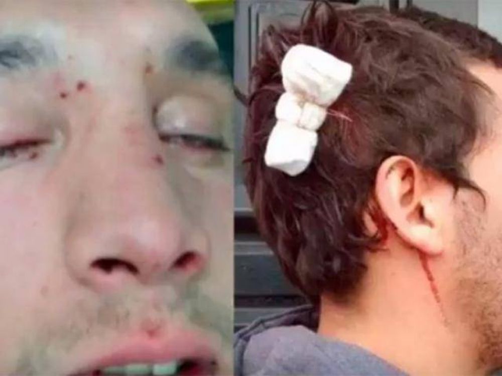 Seguir� cerrado el bar donde agredieron a Mendiburu