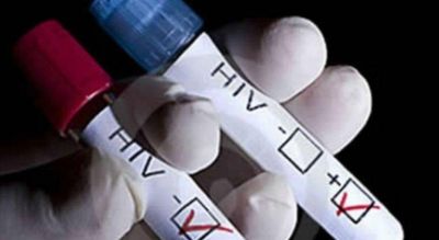 Salta mantiene en 400 los casos detectados de VIH por a�o