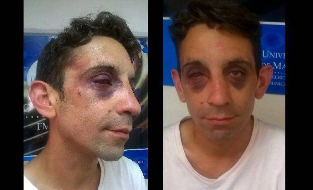 �Me pegaron y me despert� dos d�as despu�s en el Regional�