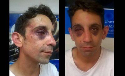 �Me pegaron y me despert� dos d�as despu�s en el Regional�