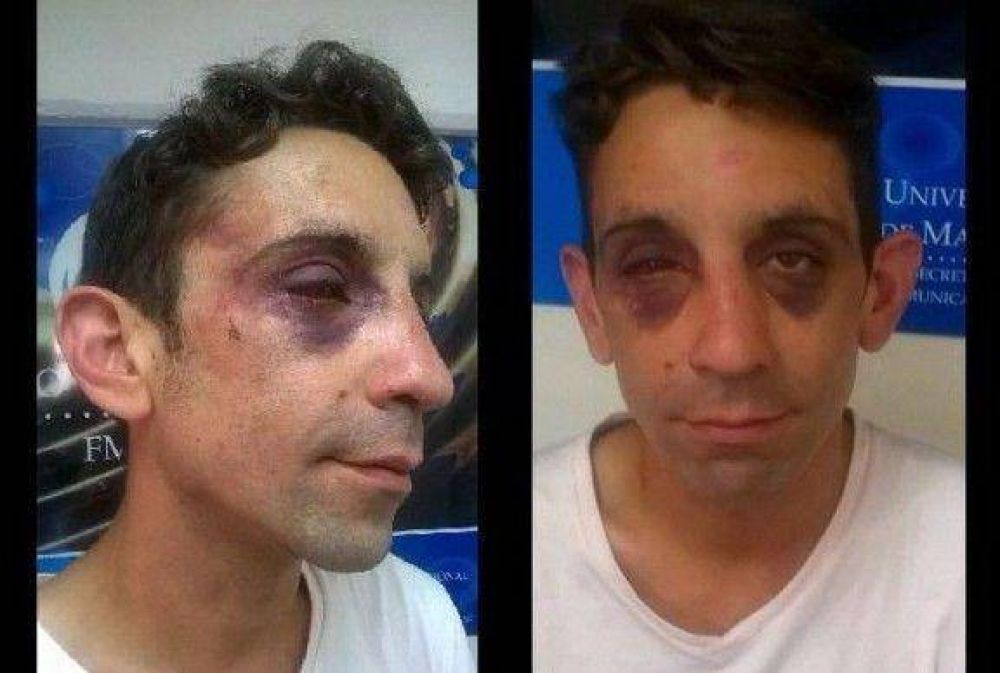 Rizzi: �Sospechamos de v�nculos entre efectivos de la Polic�a Local y los grupos neonazis� 