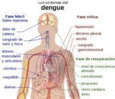 Salud P�blica confirm� que no hay casos de dengue en San Juan