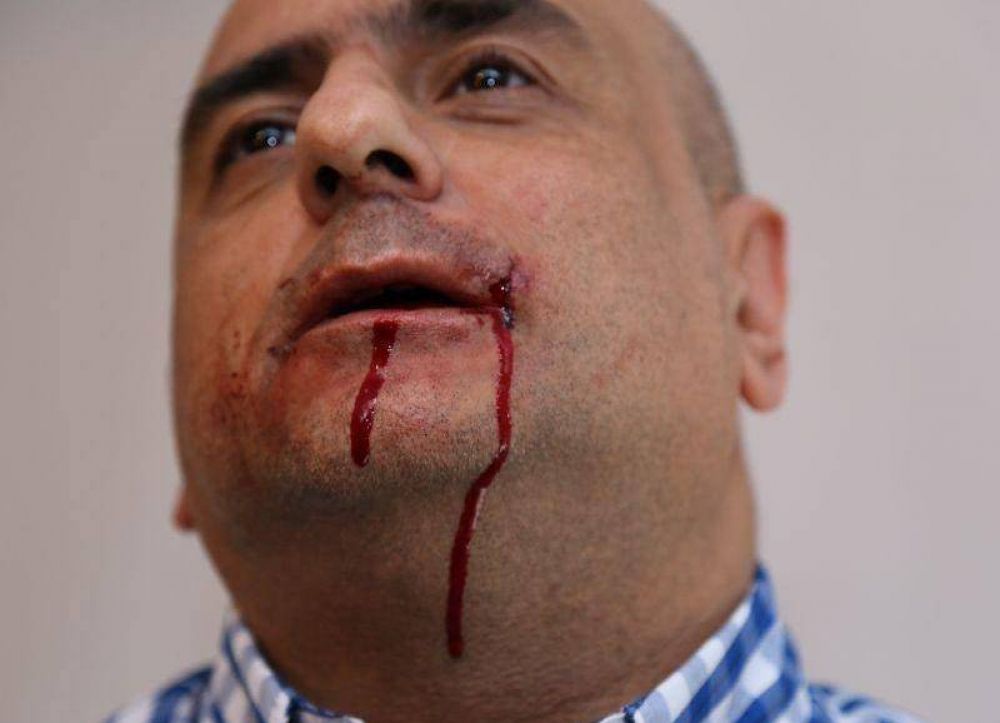 De Narvez, complicado: Piden su procesamiento por la golpiza al periodista Mario Casalongue