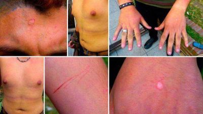 Miramar: denuncian a polic�as por secuestrar y torturar a un militante gay de 17 a�os