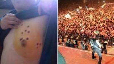 Denuncian represi�n en el recital de La Renga en Pergamino