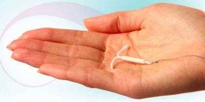 Implementar�n en Neuqu�n un nuevo m�todo anticonceptivo