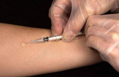 Faltan medicamentos para la tuberculosis