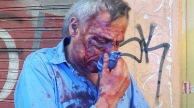 Paro en 4 l�neas de colectivos por la brutal golpiza a un chofer