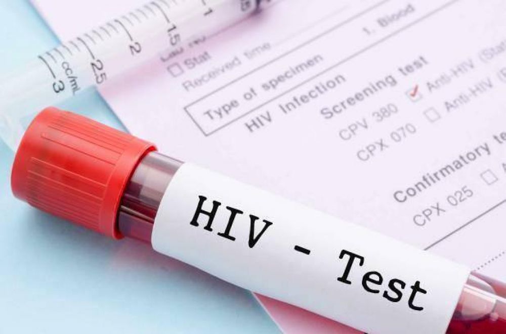 Se har�n test voluntarios por el d�a de la prueba de VIH