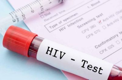 Se har�n test voluntarios por el d�a de la prueba de VIH