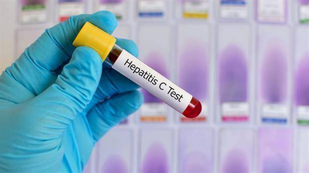 Da Mundial de la lucha contra la Hepatitis: cmo prevenirla y detectarla