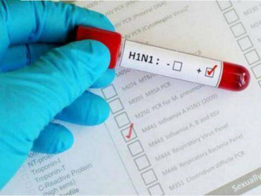 Un hombre muri� en Tres Arroyos por gripe A