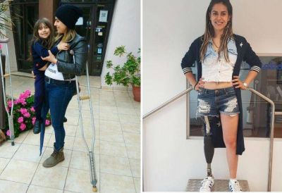 La joven madre soltera que conmovi� al pa�s consigui� su pierna ortop�dica
