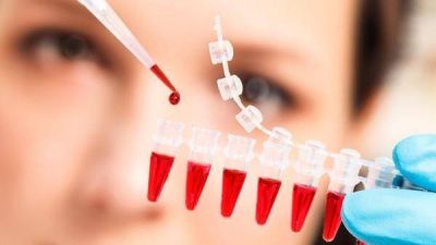 Un examen de sangre experimental logr� detectar los ocho tipos de c�ncer m�s frecuentes de forma precoz