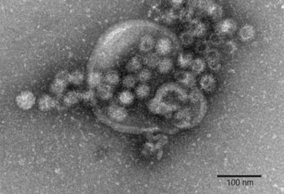 Casi 200 infectados por novovirus en los juegos ol�mpicos de Pyeongchang