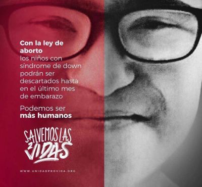 La Asociaci�n S�ndrome de Down repudia el aborto por discapacidad