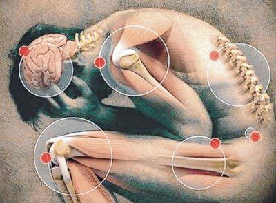 A las personas con fibromialgia les toma hasta diez a�os dar con la causa del dolor