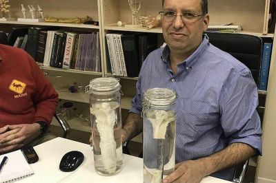 Un avance biotecnol�gico logra crear un sustituto �seo para regenerar huesos