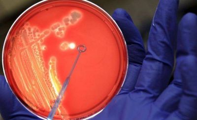 Estreptococo: investigan el origen de la bacteria que caus� la muerte de 6 personas