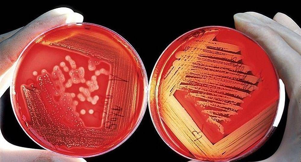 Bacteria: descartan brote y niegan que haya tomado mayor virulencia
