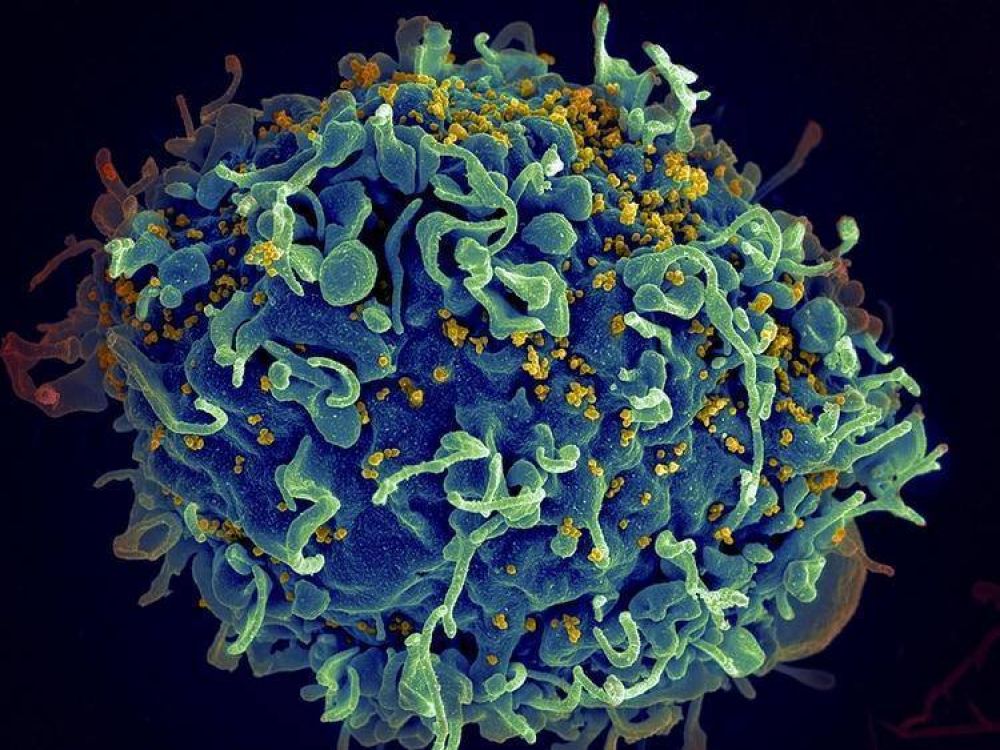 Los siete puntos actuales que definir�n el futuro del VIH/sida bajo la mirada de la ciencia