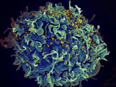 Los siete puntos actuales que definir�n el futuro del VIH/sida bajo la mirada de la ciencia